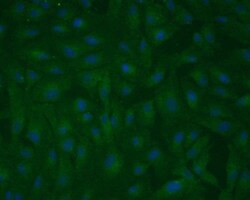 RPE65 Antibody (401.8B11.3D9) - BSA Free, Novus Biologicals 0.025mL; Unlabeled:Antibodies,